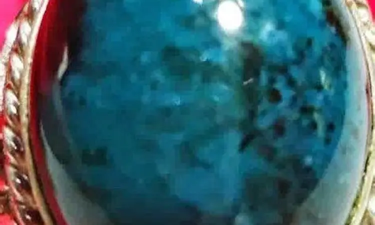 Batu Bacan Kualitas Super Koleksi batu bacan berkualitas di Pasar Rawa Bening