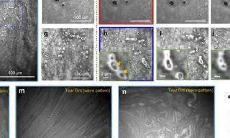 Sains di Balik Air Mata Struktur mikroskopis air mata manusia